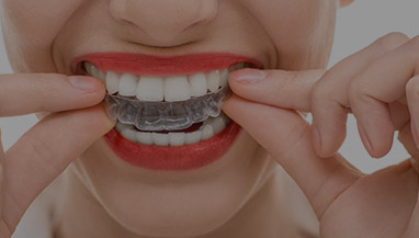 The Real Benefits of Clear Correct Invisible Braces